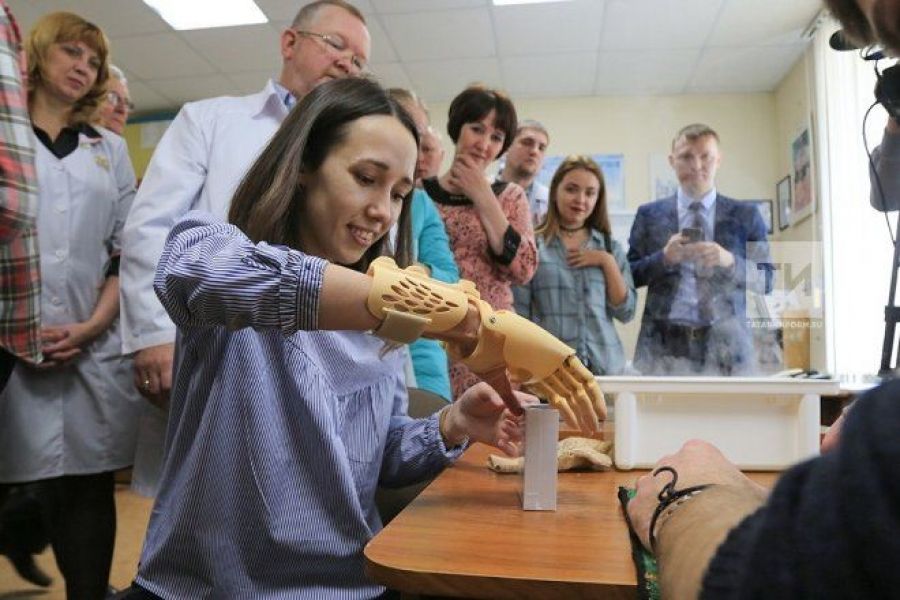 Уникальный протез кисти руки установили в Казани студентке