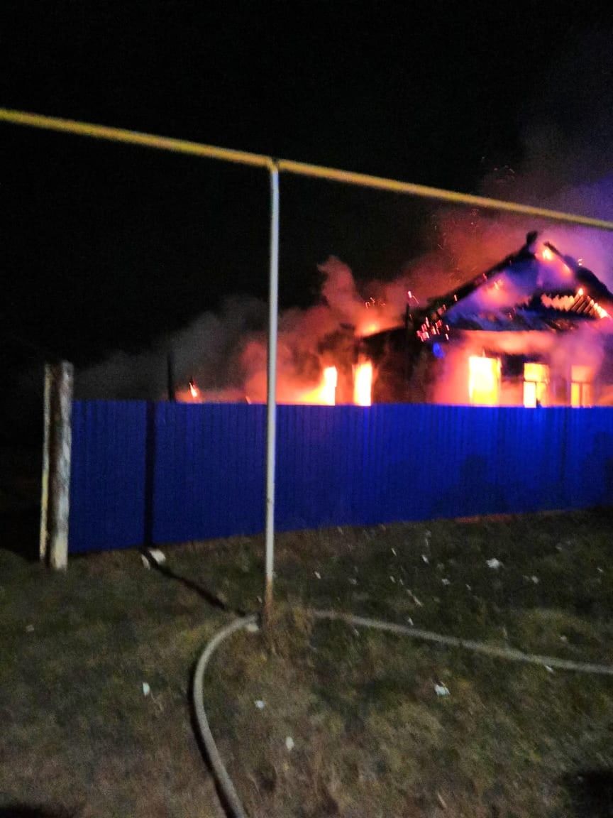 В результате пожара житель Альметьевского района получил ожоги