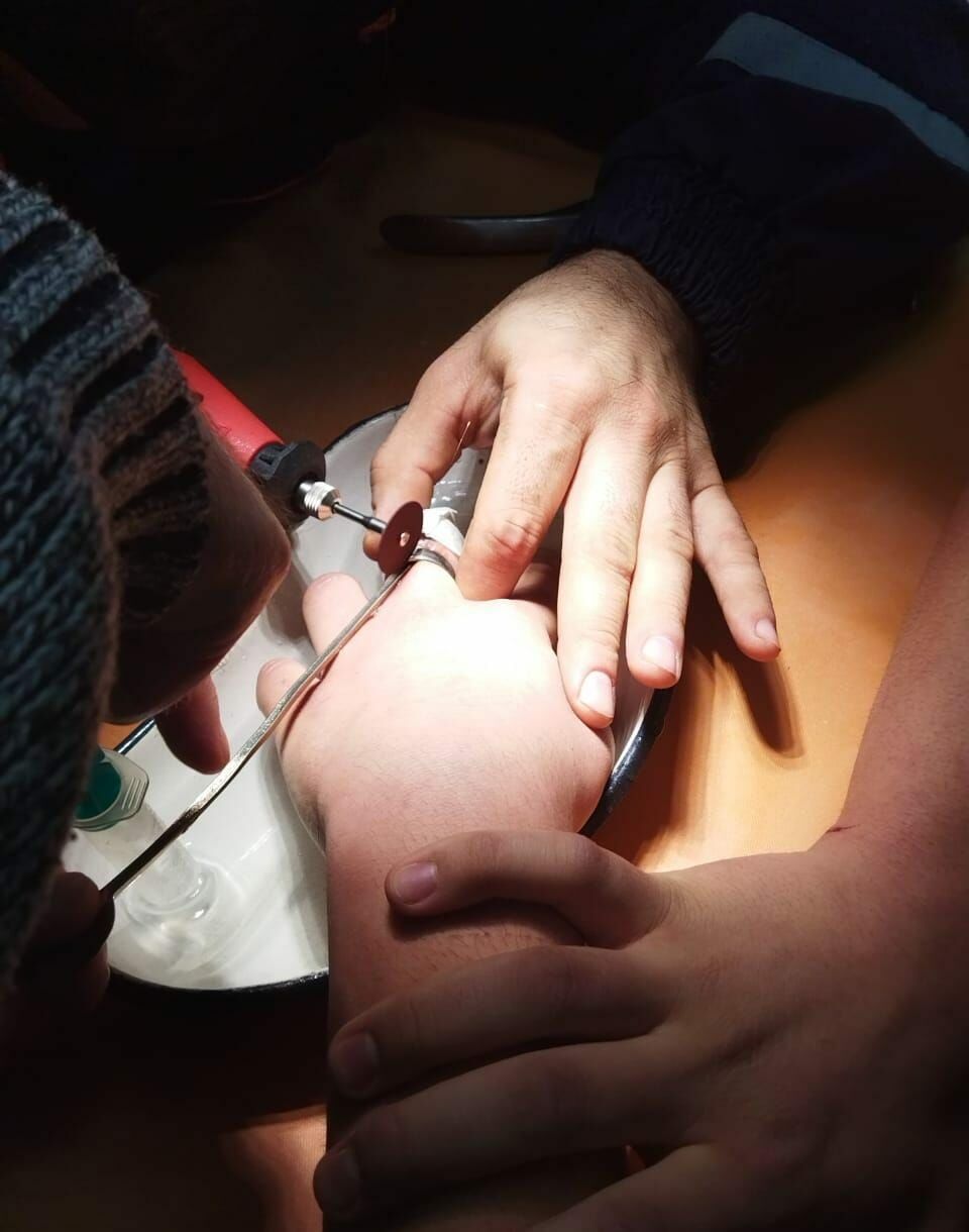 В Лениногорске спасатели помогли мальчику, у которого на пальце застряла часть подшипника