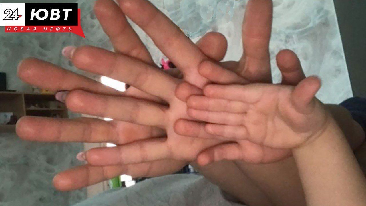 Как защитить кожу от мороза и сухости в помещении