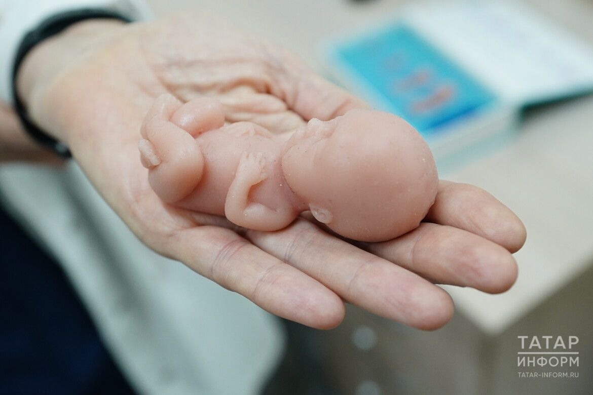 В Татарстане за пять лет число абортов снизилось в четыре раза