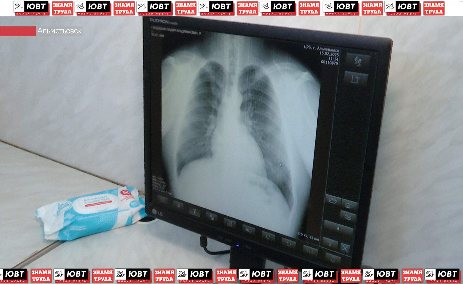 В село Новотроицкое приедет мобильный флюорографический комплекс