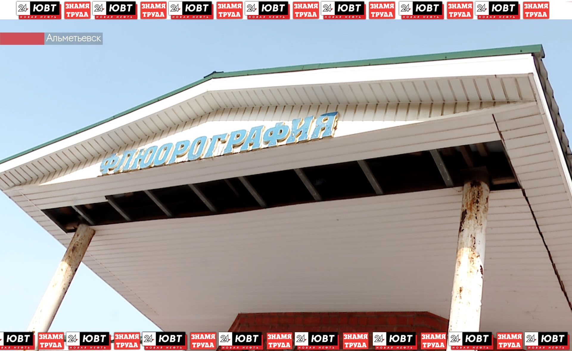 Альметьевские врачи рассказали, как распознать туберкулез и как часто нужно проходить флюорографию