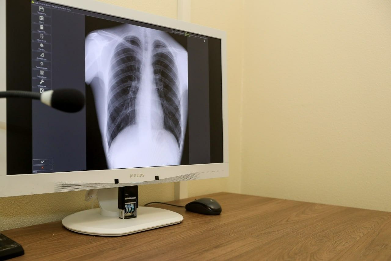 Профилактика рака легких: современный взгляд и перспективы